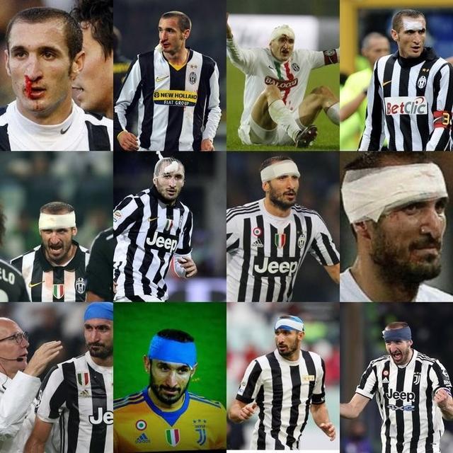 字母哥在尤文图斯比赛中比分优势明显，挺进下一轮引发热议！